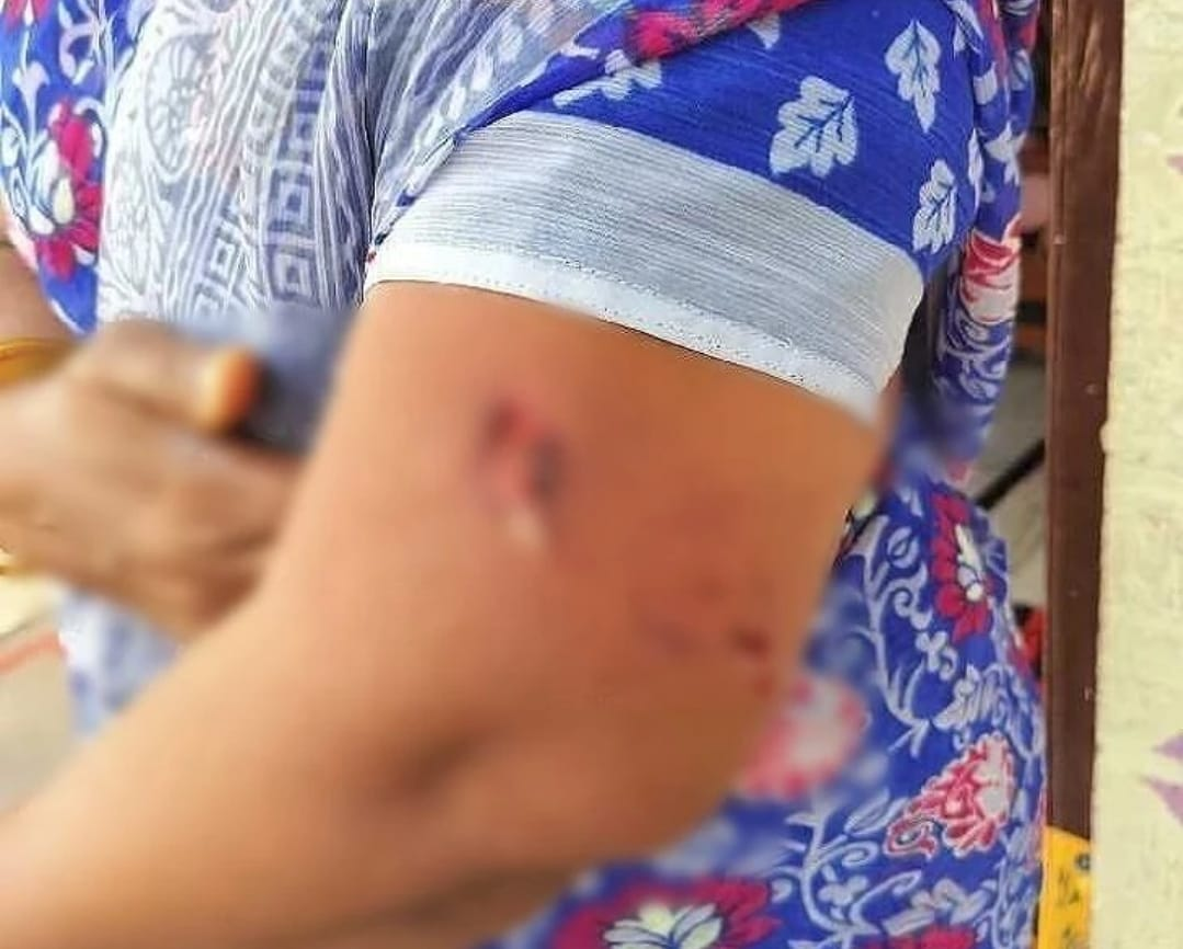 దేవర కొండ పట్టణం లో విధి కుక్కల దాడి